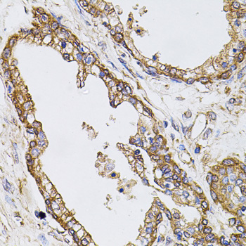 CAST Rabbit Polyclonal Antibody - Image 3