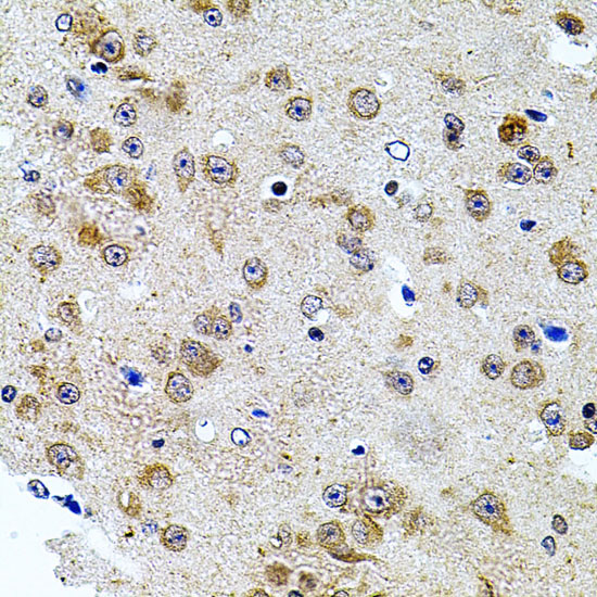 CAST Rabbit Polyclonal Antibody - Image 4