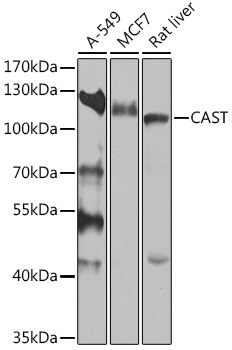 CAST Rabbit Polyclonal Antibody