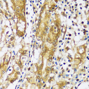CAST Rabbit Polyclonal Antibody - Image 2