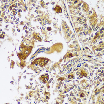 CAST Rabbit Polyclonal Antibody - Image 3