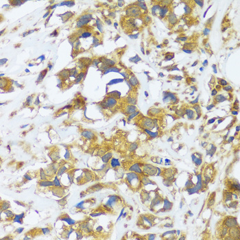 CAST Rabbit Polyclonal Antibody