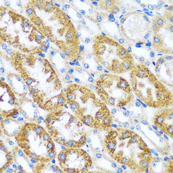 CAST Rabbit Polyclonal Antibody - Image 2