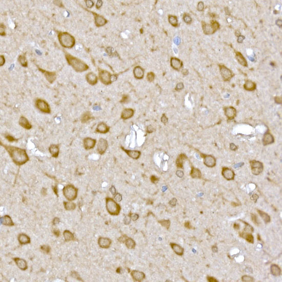 CASTOR1 Rabbit Polyclonal Antibody - Image 2