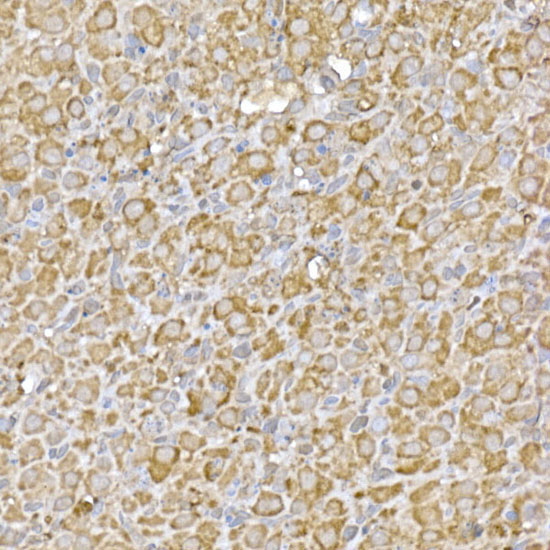 CASTOR1 Rabbit Polyclonal Antibody - Image 3