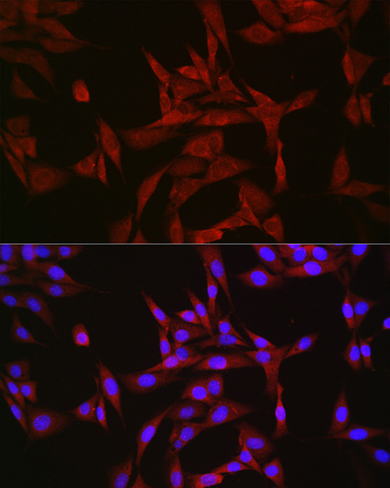 CASTOR1 Rabbit Polyclonal Antibody - Image 4