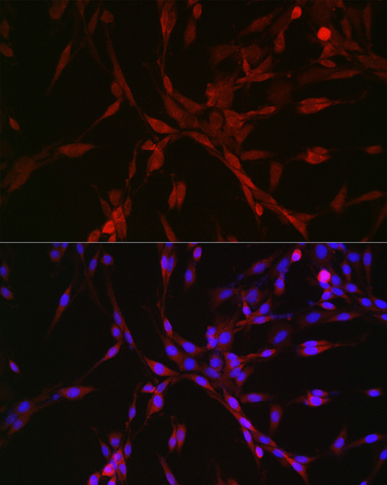 CASTOR1 Rabbit Polyclonal Antibody - Image 5