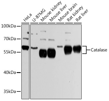 Catalase Rabbit Polyclonal Antibody