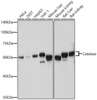 Catalase Rabbit Polyclonal Antibody