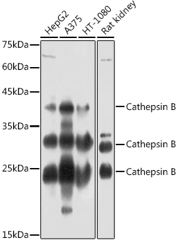 Cathepsin B Rabbit Polyclonal Antibody
