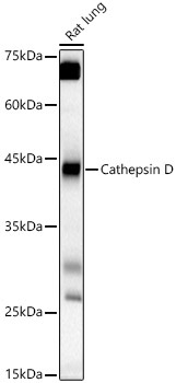 Cathepsin D Rabbit Polyclonal Antibody - Image 2