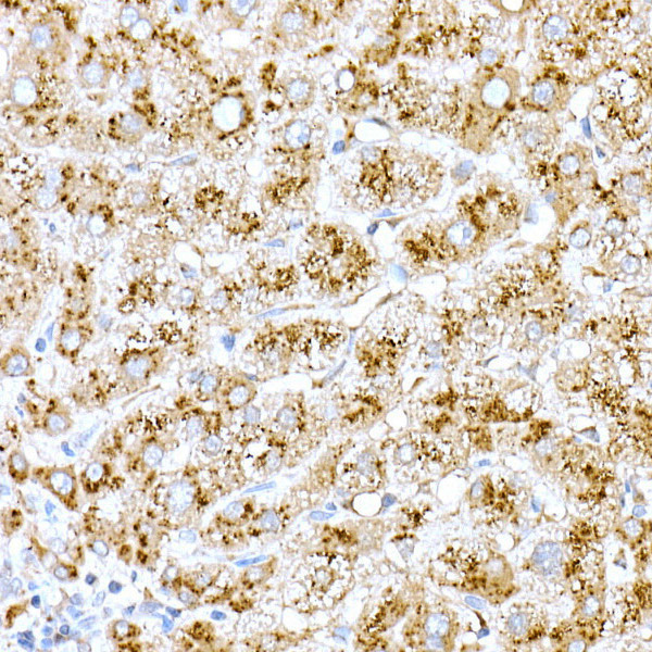 Cathepsin D Rabbit Polyclonal Antibody - Image 3