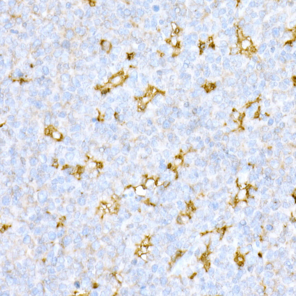 Cathepsin D Rabbit Polyclonal Antibody - Image 4