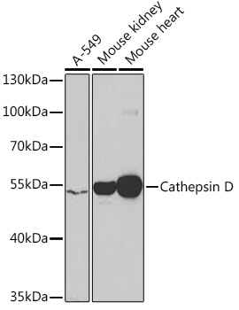 Cathepsin D Rabbit Polyclonal Antibody