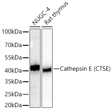 Cathepsin E (CTSE) Rabbit Monoclonal Antibody