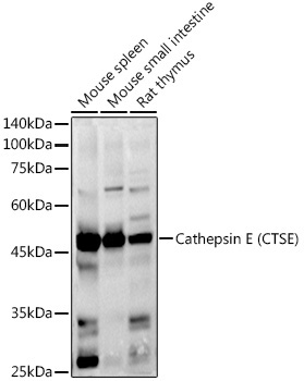 Cathepsin E (CTSE) Rabbit Polyclonal Antibody