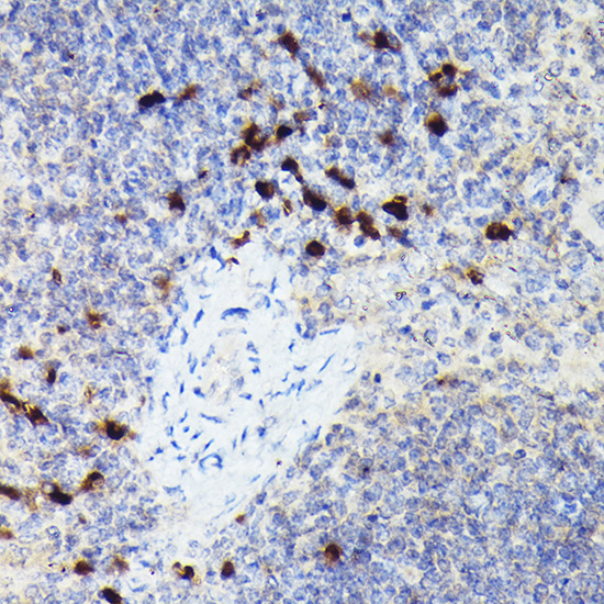 Cathepsin G Rabbit Polyclonal Antibody - Image 4