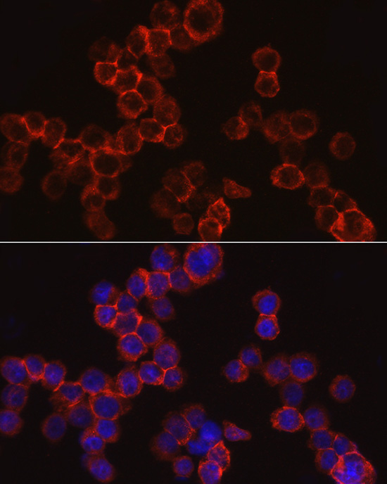 Cathepsin G Rabbit Polyclonal Antibody - Image 6