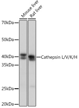 Cathepsin L/V/K/H Rabbit Monoclonal Antibody