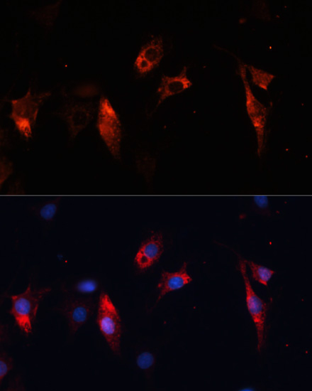 Cathepsin L/V/K/H Rabbit Polyclonal Antibody - Image 2