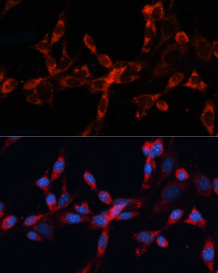 Cathepsin L/V/K/H Rabbit Polyclonal Antibody - Image 3