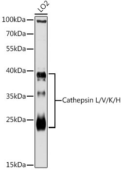 Cathepsin L/V/K/H Rabbit Polyclonal Antibody