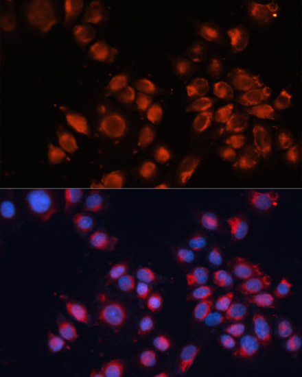 Cation-independent M6PR (IGF2R) Rabbit Polyclonal Antibody - Image 3