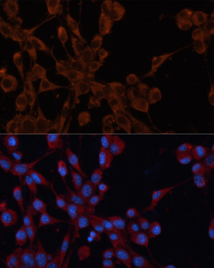 Cation-independent M6PR (IGF2R) Rabbit Polyclonal Antibody - Image 4
