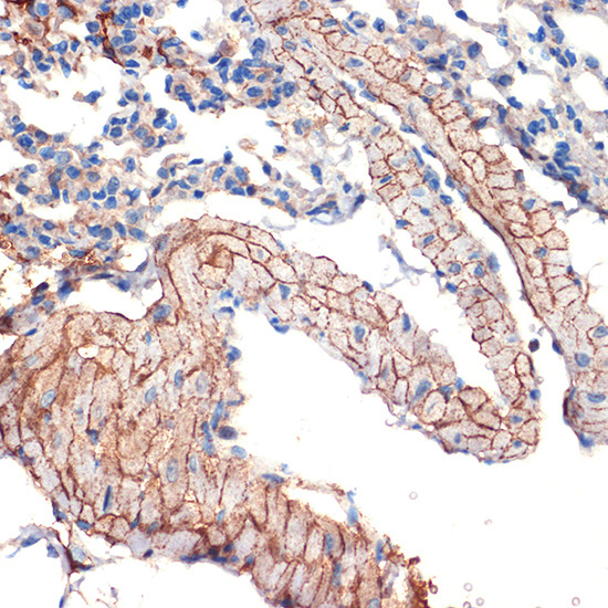 Caveolin-3 Rabbit Monoclonal Antibody - Image 3