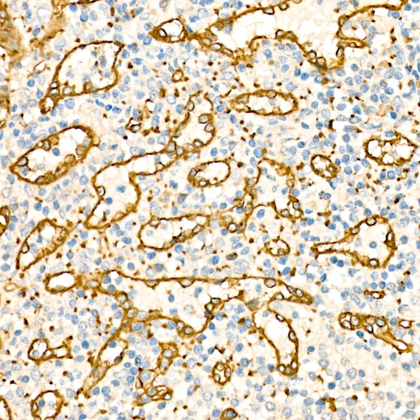 CAVIN2 Rabbit Polyclonal Antibody - Image 2