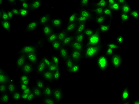 CBFA2T2 Rabbit Polyclonal Antibody - Image 2