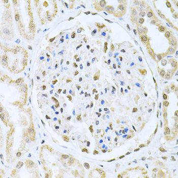 CBFB Rabbit Polyclonal Antibody - Image 3