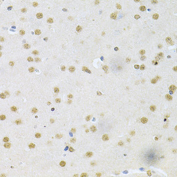 CBFB Rabbit Polyclonal Antibody - Image 4