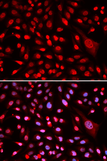 CBFB Rabbit Polyclonal Antibody - Image 5