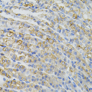 CBL Rabbit Polyclonal Antibody - Image 2