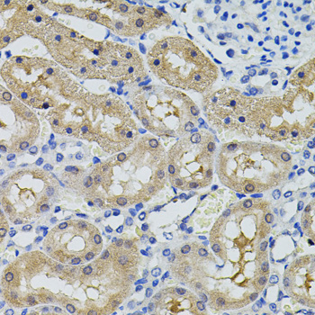 CBL Rabbit Polyclonal Antibody - Image 3