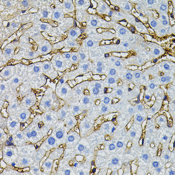 CBL Rabbit Polyclonal Antibody - Image 4