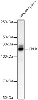 CBLB Rabbit Polyclonal Antibody - Image 2