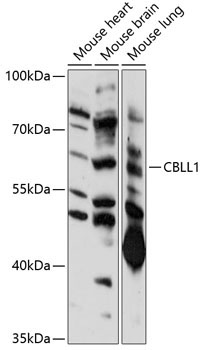 CBLL1 Rabbit Polyclonal Antibody