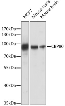 CBP80 Rabbit Polyclonal Antibody