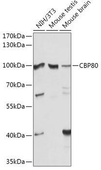 CBP80 Rabbit Polyclonal Antibody - Image 2