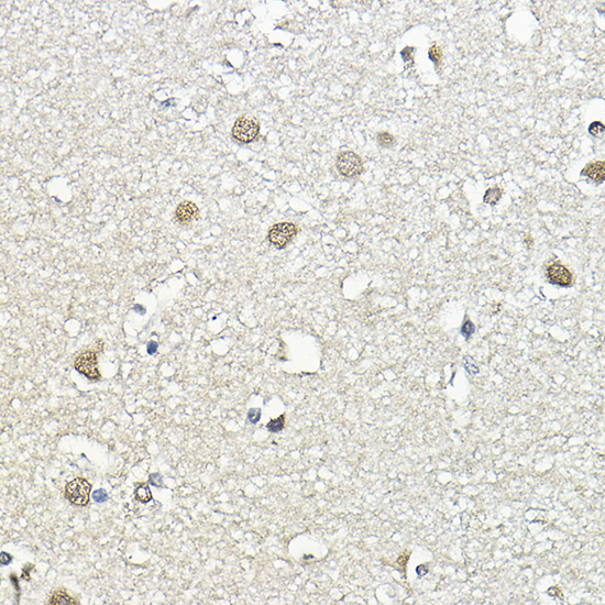CBP80 Rabbit Polyclonal Antibody - Image 3