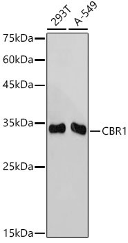 CBR1 Rabbit Monoclonal Antibody
