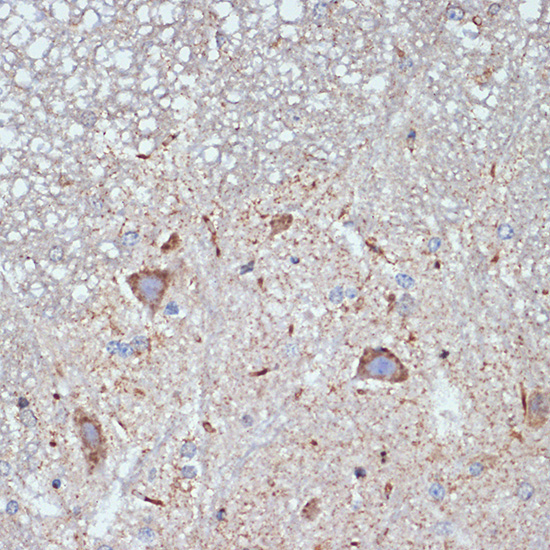 CBR1 Rabbit Monoclonal Antibody - Image 2