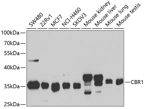 CBR1 Rabbit Polyclonal Antibody