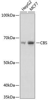 CBS Rabbit Monoclonal Antibody