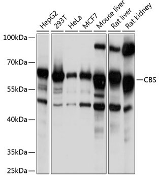CBS Rabbit Polyclonal Antibody