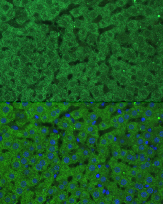 CBS Rabbit Polyclonal Antibody - Image 2