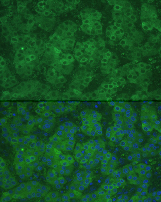 CBS Rabbit Polyclonal Antibody - Image 3