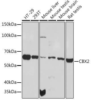 CBX2 Rabbit Monoclonal Antibody